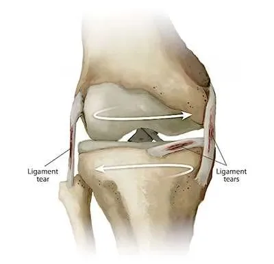 Knee Joint London