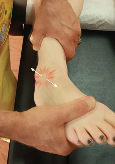 Ankle & Achilles Pain London Mobile